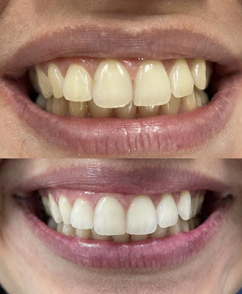 Foto 3 de Dentista em Recife - Dra. Thallyta Maia