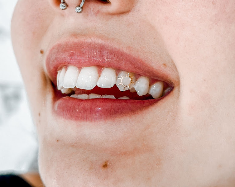 Foto 2 de Dentista Em Ribeirão Preto - Dra Sthéfani Guedes