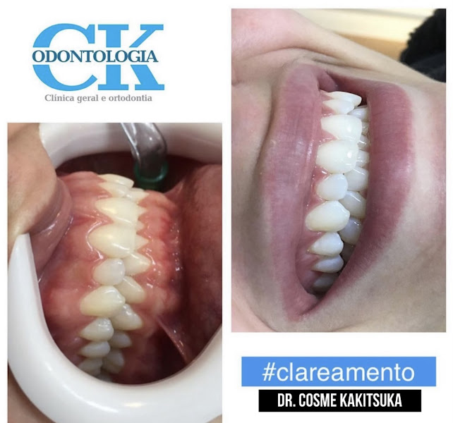 Foto 3 de Dentista em Santana de Parnaíba Dr Cosme Damião Kakitsuka