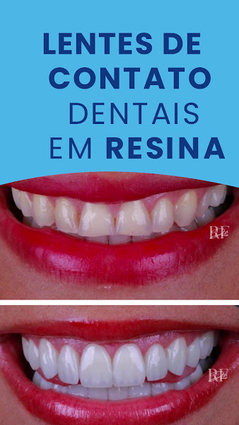 Foto 3 de Dentista em Santo André - Dr. Raihan Felipe
