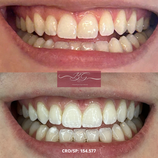 Foto 3 de Dentista em Santos - B&G Clínica Odontológica