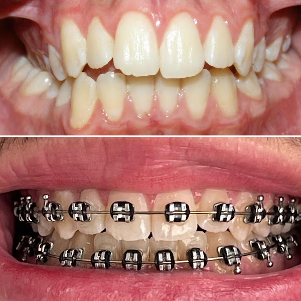 Foto 3 de Dentista em São Carlos | Dr. Diego Ribeiro de Matos | Invisalign | Lente de Contato | Aparelho