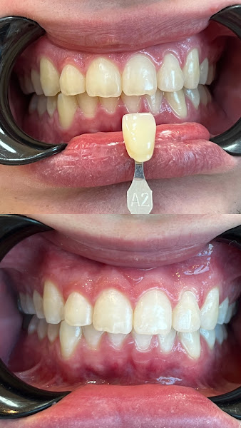 Foto 2 de Dentista em São Gonçalo | Dra. Fernanda Bizzo | Clareamento e Prótese Dentária