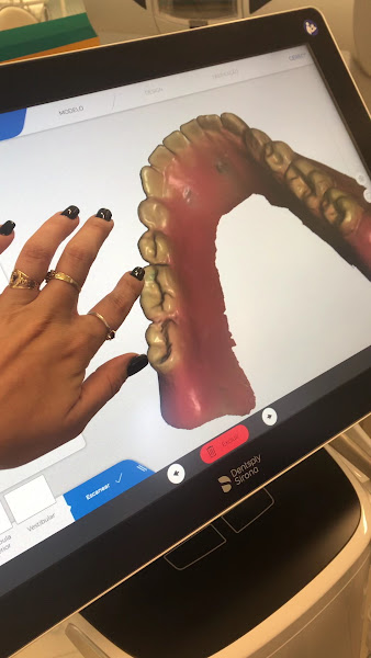 Foto 3 de Dentista em São Paulo | Melhores dentistas | Dra. Thais Vinha | Prótese Dentária