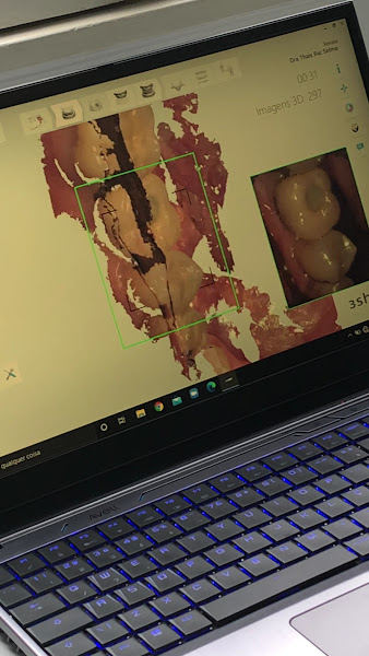 Foto 4 de Dentista em São Paulo | Melhores dentistas | Dra. Thais Vinha | Prótese Dentária