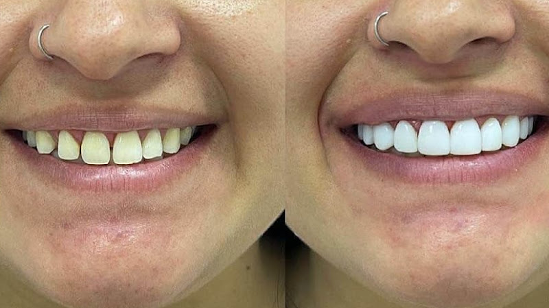 Foto 2 de DENTISTA EM SÃO VICENTE - ORAL MARTINS