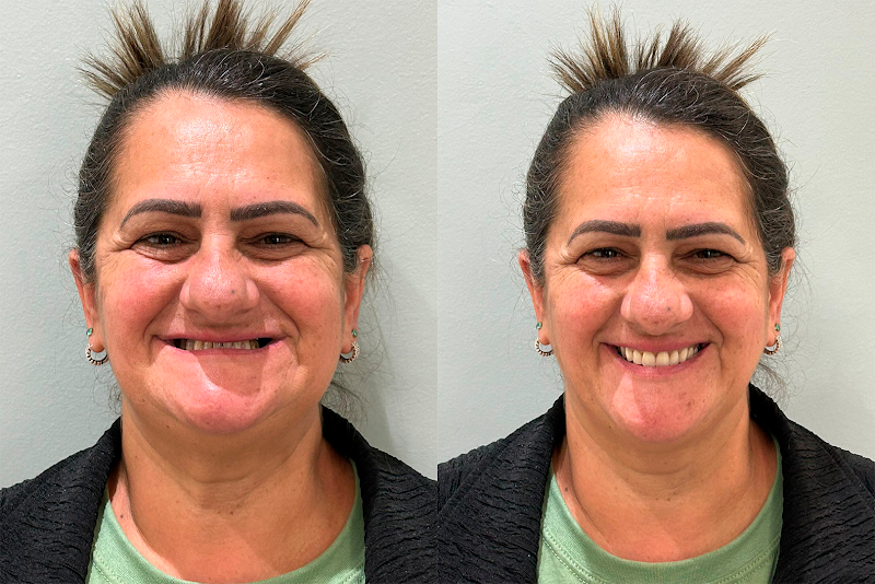 Foto 2 de Dentista em SBC | Lente para os dentes | Implante dentário | Gengivoplastia | Dr. Enzo Garcia