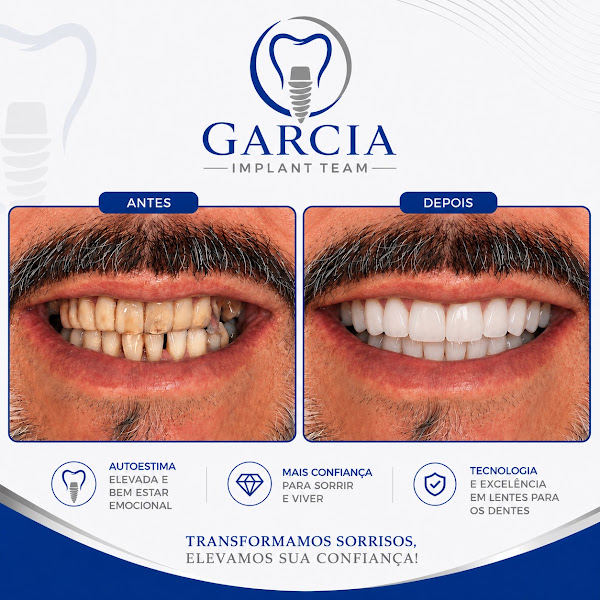 Foto 3 de Dentista em SBC | Lente para os dentes | Implante dentário | Gengivoplastia | Dr. Enzo Garcia