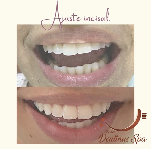 Foto 3 de Dentista em Sobral - Dentinus Spa