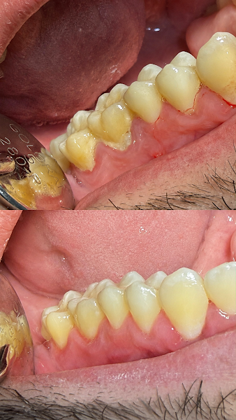 Foto 2 de Dentista em Taubaté - Dr Kaique Vieira