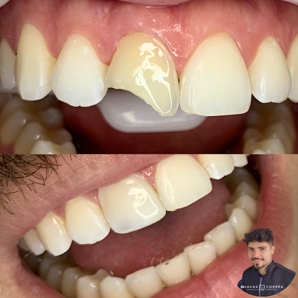 Foto 2 de Dentista Emergencia 24h em Guarujá Dr. Lucas Ruco