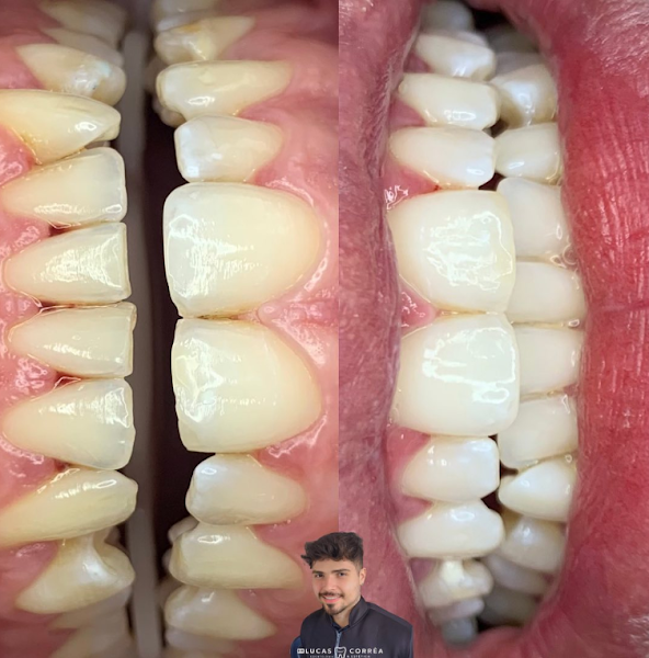 Foto 3 de Dentista Emergencia 24h em Guarujá Dr. Lucas Ruco