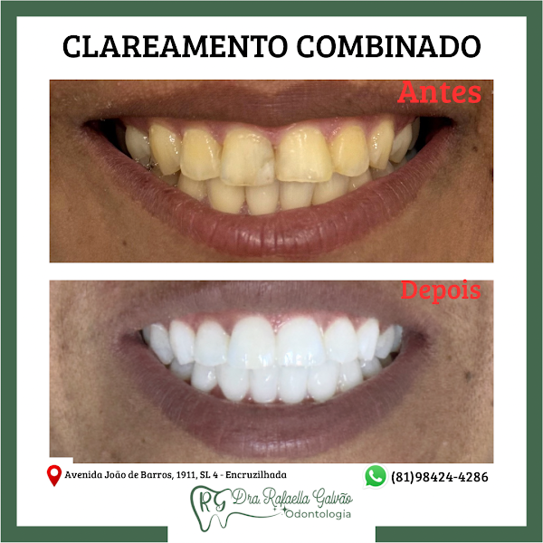 Foto 3 de Dentista Encruzilhada- Dra Rafaella Galvão Odontologia