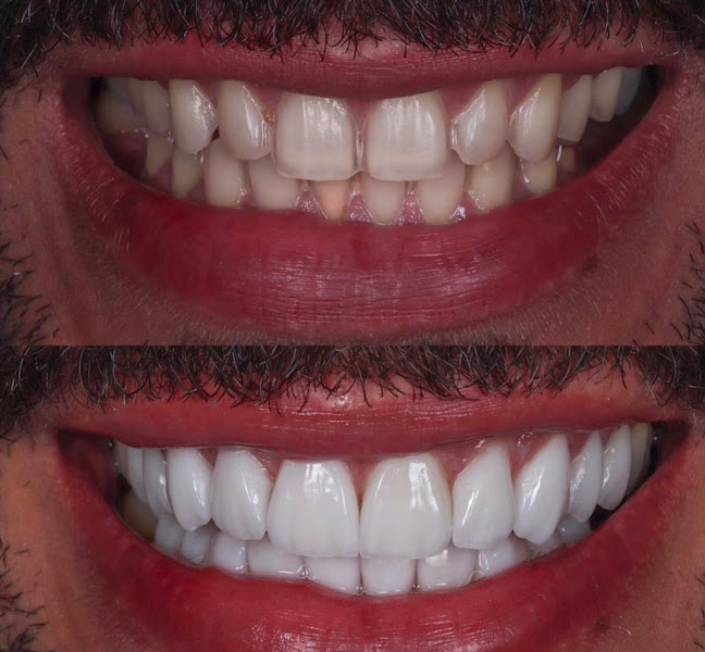 Foto 2 de Dentista Érica Oliveira