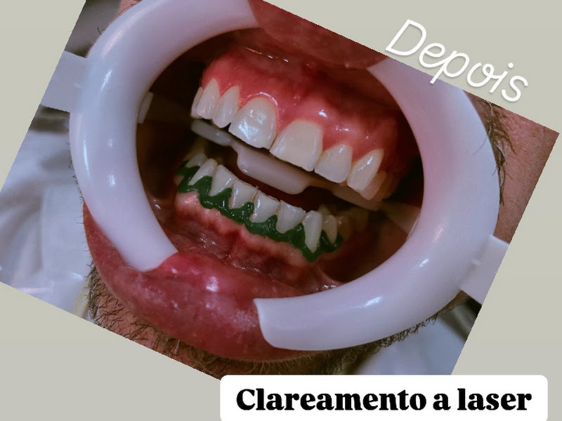 Foto 10 de Dentista Erika Moraes Odontologia Estética