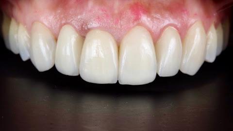 Foto 2 de Dentista especialista em Implantes e Próteses Dentárias - Porto Alegre | Dra. Bruna Gravina