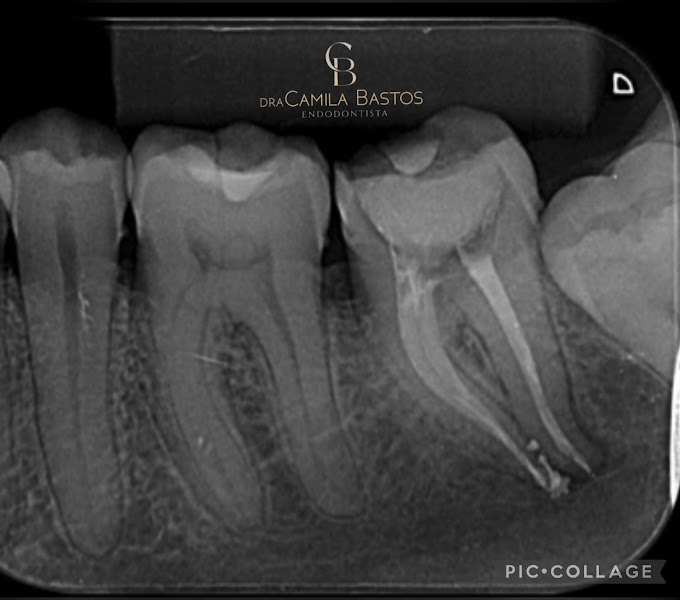 Foto 3 de Dentista,especialista em tratamento de canal SJC, endodontista, Dra. Camila Bastos