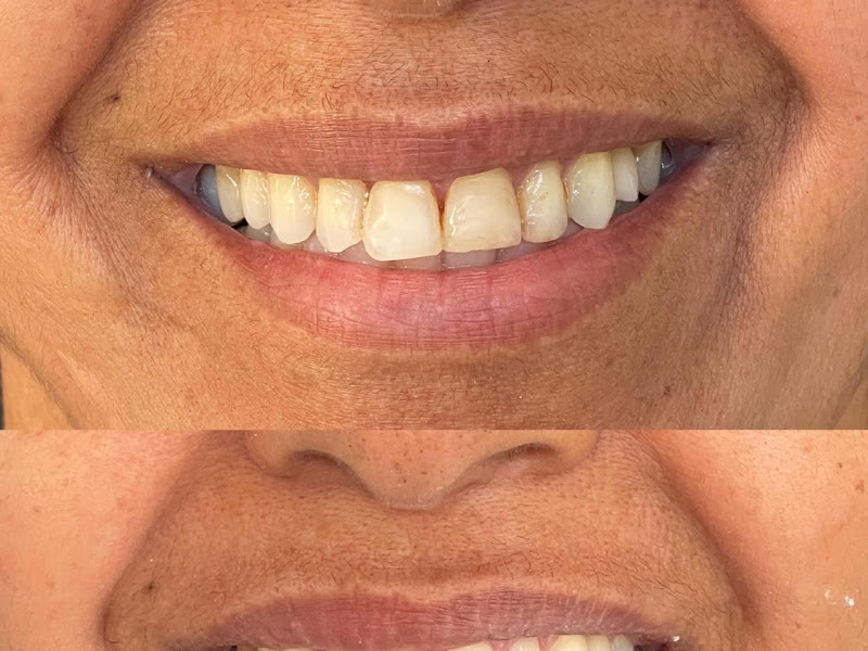 Foto 7 de Dentista | FaceDent Odontologia