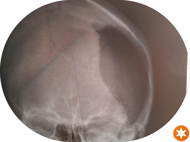 Foto 3 de Dentista Francisco C.Stroparo