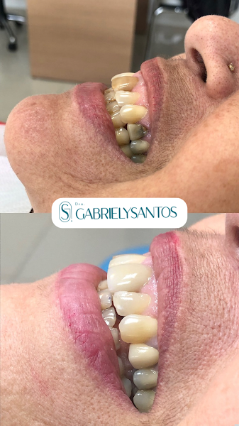 Foto 2 de DENTISTA GABRIELY SANTOS