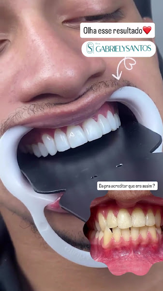 Foto 3 de DENTISTA GABRIELY SANTOS