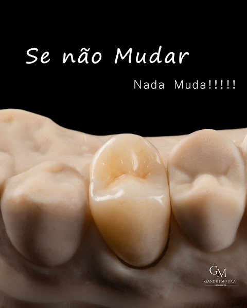 Foto 3 de Dentista Gandhi Moura - Vitória da Conquista
