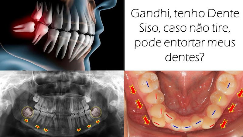 Foto 5 de Dentista Gandhi Moura - Vitória da Conquista