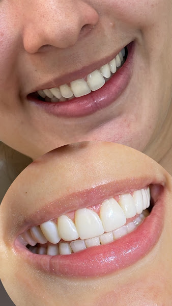 Foto 3 de Dentista Giordana Oliveira | Especialista em Odontologia Estética Campo Grande/MS