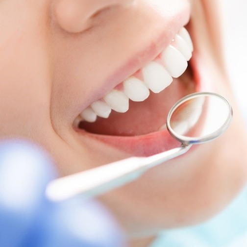 Foto 2 de Dentista Guaianases - Dr Saúde e Sorriso| Implante Dentario| Aparelho Ortodontico | Limpeza | Clareamento | Extrações