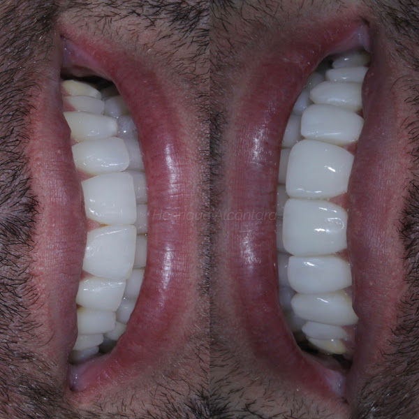 Foto 3 de Dentista Henrique Alcântara