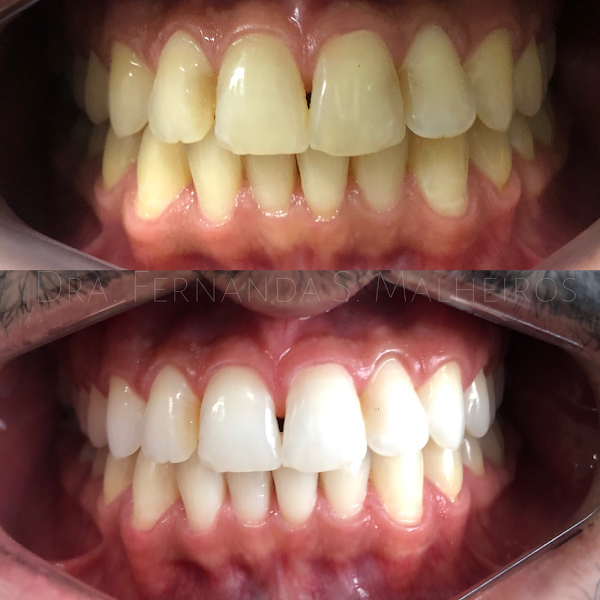 Foto 3 de Dentista | Implante Dentário | Cumiotto Odonto