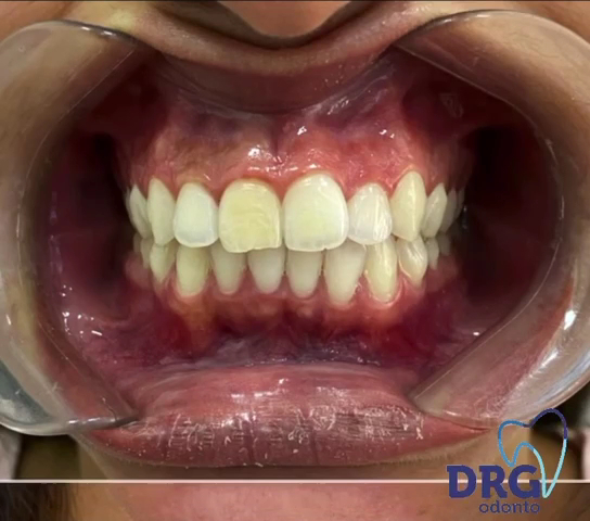 Foto 3 de Dentista | Implante Dentário | DRG Odonto | Vila Francisco de Tulio | Franco da Rocha - SP