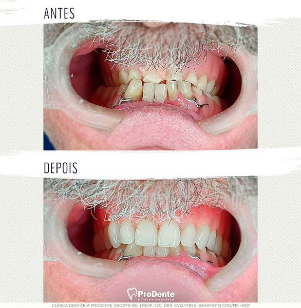 Foto 3 de Dentista | Implante Dentário | ProDente Clínica Dentaria | Jardim Caramuru | Dourados - MS