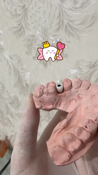 Foto 2 de Dentista Implantes Guarujá Dra Mariane Andrade Franzoni