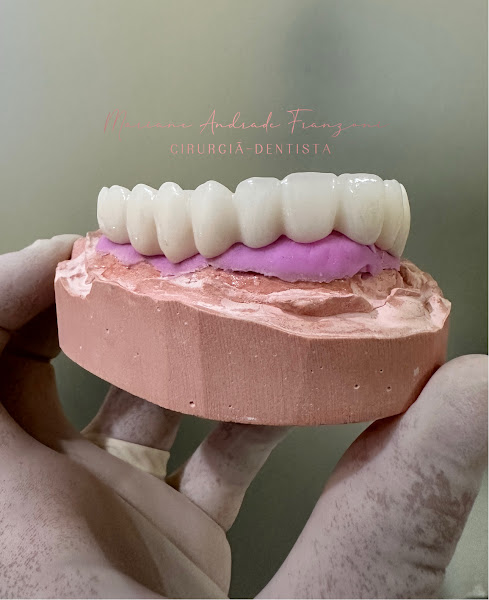 Foto 3 de Dentista Implantes Guarujá Dra Mariane Andrade Franzoni