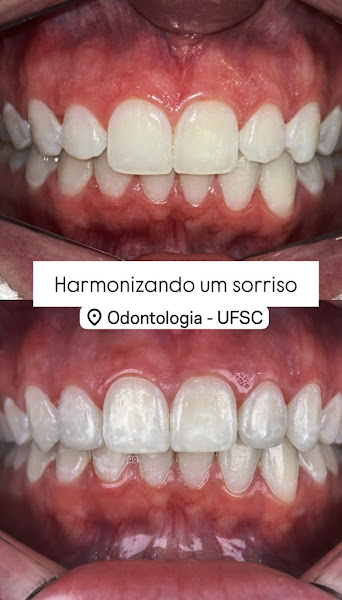 Foto 2 de Dentista Ingleses - Dr. Leandro Nunes