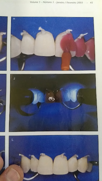 Foto 3 de Dentista Itaim Paulista - Dr. Guilherme