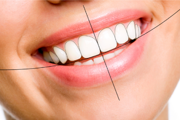 Foto 2 de Dentista Jaçanã - Leone Odontologia