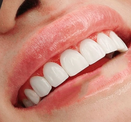 Foto 3 de Dentista Jaçanã - Leone Odontologia