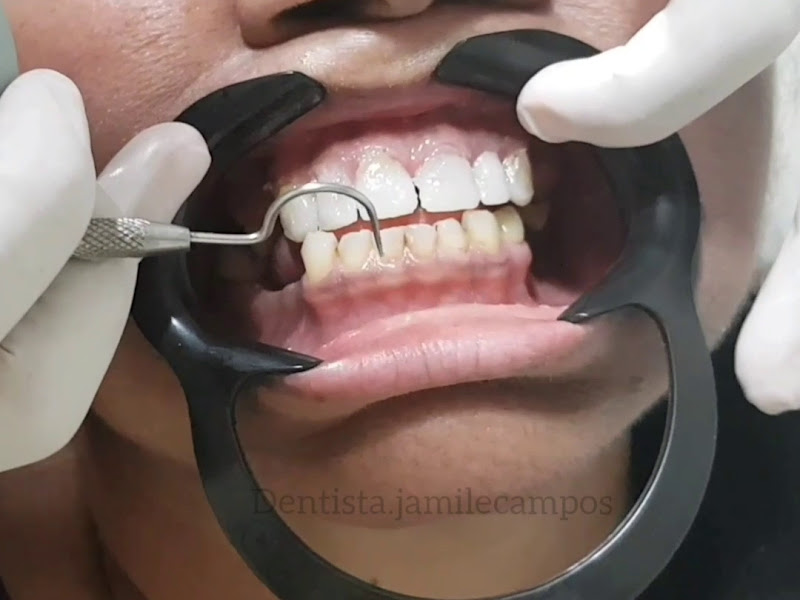 Foto 3 de Dentista Jamile Campos - Dentista em Manaus
