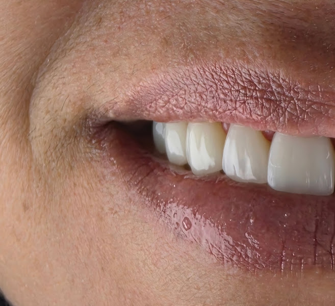 Foto 2 de Dentista - João Otávio Ribeiro