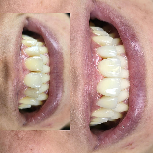 Foto 3 de Dentista - João Otávio Ribeiro