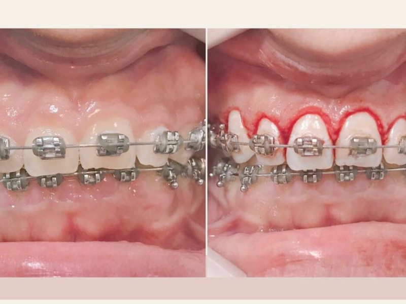 Foto 2 de Dentista Josiane Ferreira