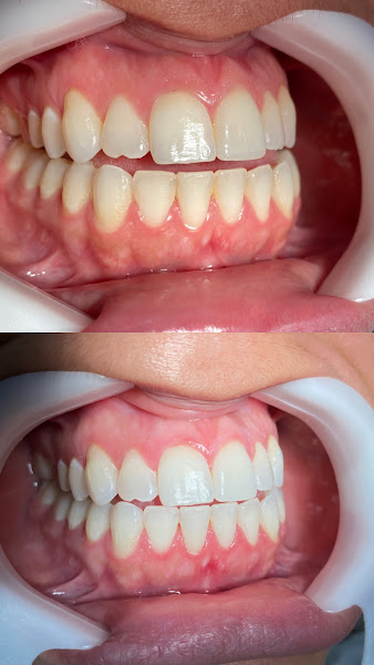 Foto 2 de Dentista Juiz de Fora | Dr. Matheus Nascimento