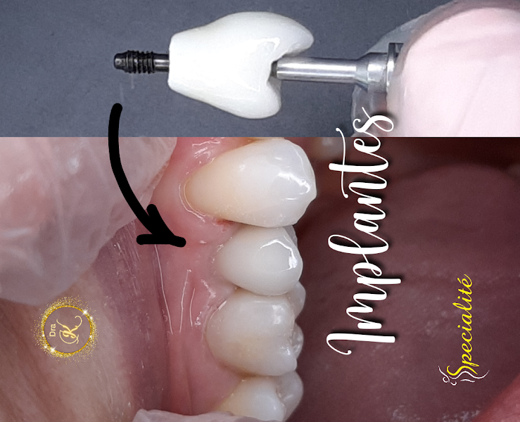 Foto 3 de Dentista KAREN MARTINS KAISER CRO18229