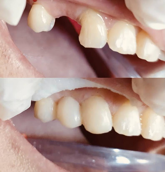 Foto 2 de Dentista Katariny Sampaio