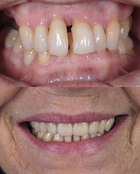 Foto 3 de Dentista Larissa Rodrigues (Pilares/RJ)