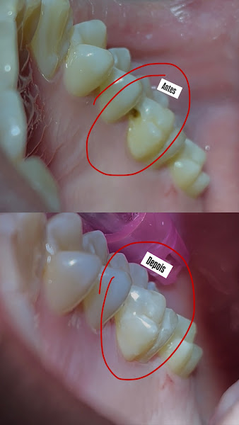 Foto 3 de Dentista Leandro Almeida