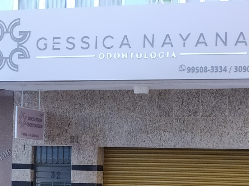 Foto 7 de Dentista Loren Sossai | Facetas | Lentes em Resina