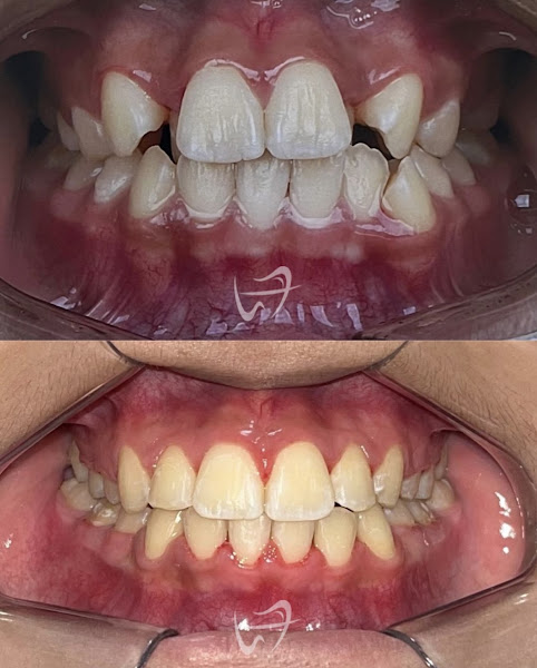 Foto 3 de Dentista - Lucas Fernandes Odontologia